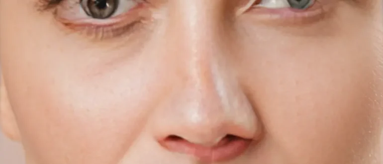 Перспективные методы лечения кожи после 30 лет